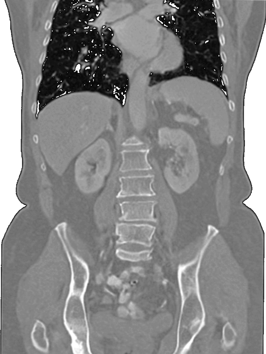 Body Organ Segmentation